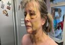 Kay Crisp was left with serious injuries after an attack in Mendlesham