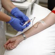 Is there a two-tier service for blood tests between Suffolk and Essex?