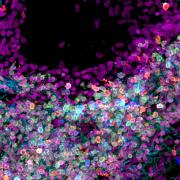 Human lung tissue represented in waves of purple, pink and blue circles (Nathan Richoz/University of Cambridge