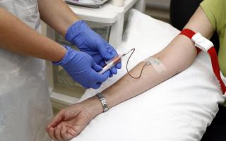 Is there a two-tier service for blood tests between Suffolk and Essex?